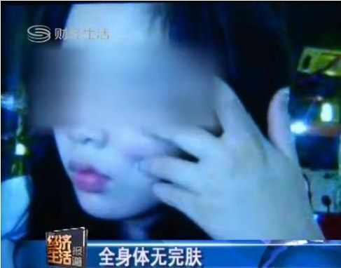 桑拿女被男友虐待48小時