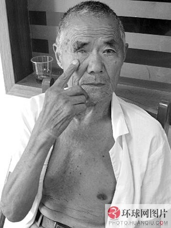 桑拿女被男友虐待48小時 乳頭被燙傷腳底皮被烤熟（組圖）