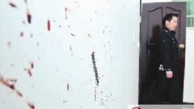 桑拿女被男友虐待48小時 乳頭被燙傷腳底皮被烤熟（組圖）