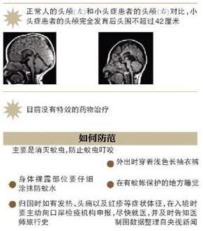 虎眼美股熱評：寨卡病毒肆虐 相關股票暴漲