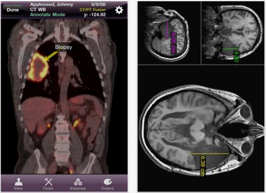 美青少年愛用智慧型手機關心健康 手機廣告成藥廠行銷利器