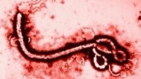 WHO已排除是伊波拉病毒、黃熱病或拉薩病毒。圖為伊波拉病毒。 (圖取材自網路)