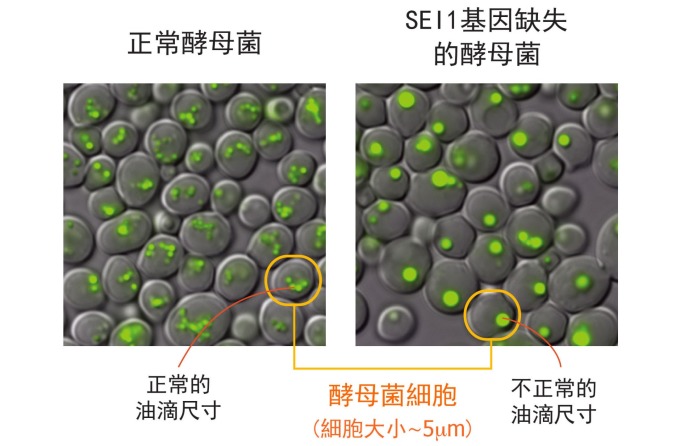 左圖為正常酵母菌細胞,右圖為酵母菌單一基因 SEI1 的突變株,右圖明顯可見:細胞中綠色部分標示的油滴尺寸變大、且數量變少。 圖片來源│王昭雯