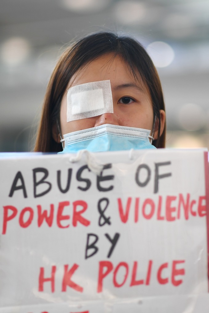 香港網友發起「警察還眼」行動,由於一名女子右眼中彈,引發香港民眾震怒,警民衝突加劇。(圖片:AFP)