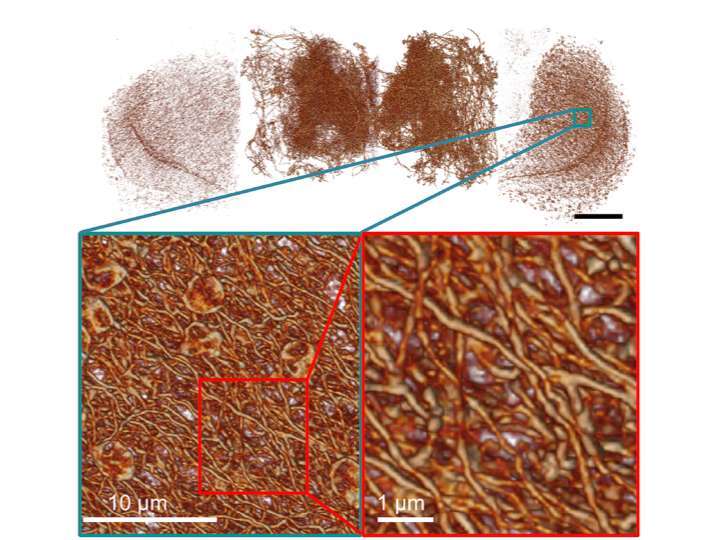 果蠅全腦多巴胺神經多尺度圖像 (上)，細部的神經結構 (左下)，以及放大展現出非常複雜、但可經由新顯微術辨識的神經網路 (右下)。 圖片來源│陳壁彰