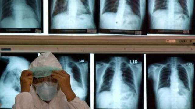 新冠肺炎疫情更新:檢測能力不足?美國CDC修改新冠檢測規定(圖片:AFP)