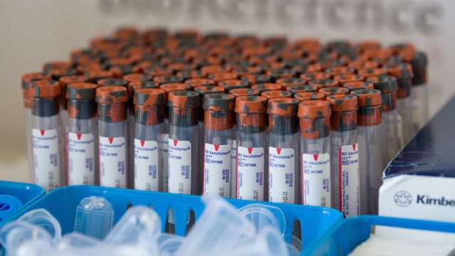 高端新冠疫苗即將開打 500萬劑年底前全數交貨營運拚轉盈。(圖:AFP)
