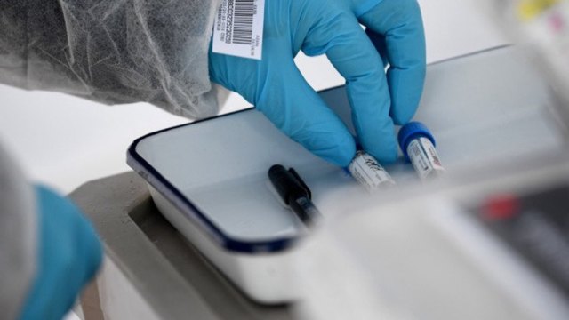 安盛生新冠抗原快篩 獲食藥署專案製造許可。（圖：AFP）