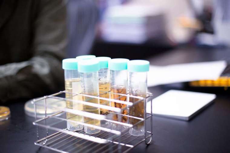 蔡怡陞實驗室中，放入培養液和樣本的 6 支試管。培養液相當重要，負責讓低調但無處不在的釀酒酵母現身。 圖│研之有物