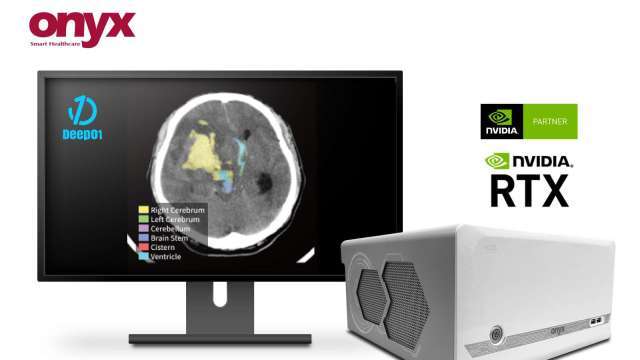 醫揚Deep01合作推廣腦部影像AI辨識系統，提供最佳醫療影像AI方案。(圖:醫揚提供)