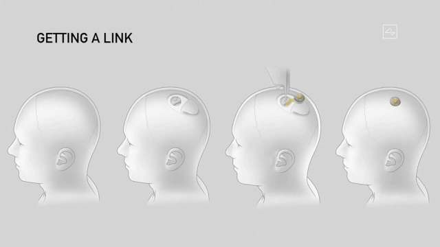 馬斯克：Neuralink有望六個月內展開人體實驗 (圖：AFP)