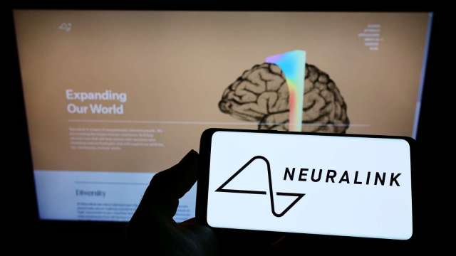 馬斯克Neuralink獲FDA批准 可進行腦機介面人體試驗 (圖:Shutterstock)