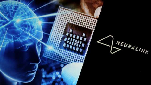 AI+腦機接口助力:漸凍症患者重獲「發聲」能力(圖:shutterstock)