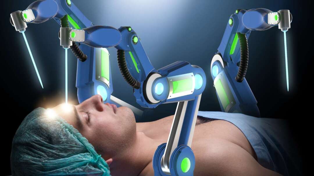 評価額11億ドルのユニコーンから破産清算へ　Vicarious Surgicalが医療ロボット業界に警鐘