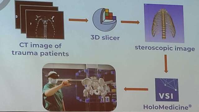 从1周变半小时！台湾独研AI 3D重构技术 医疗「元宇宙」助攻精准手术